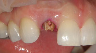 Smile Gallery - Before